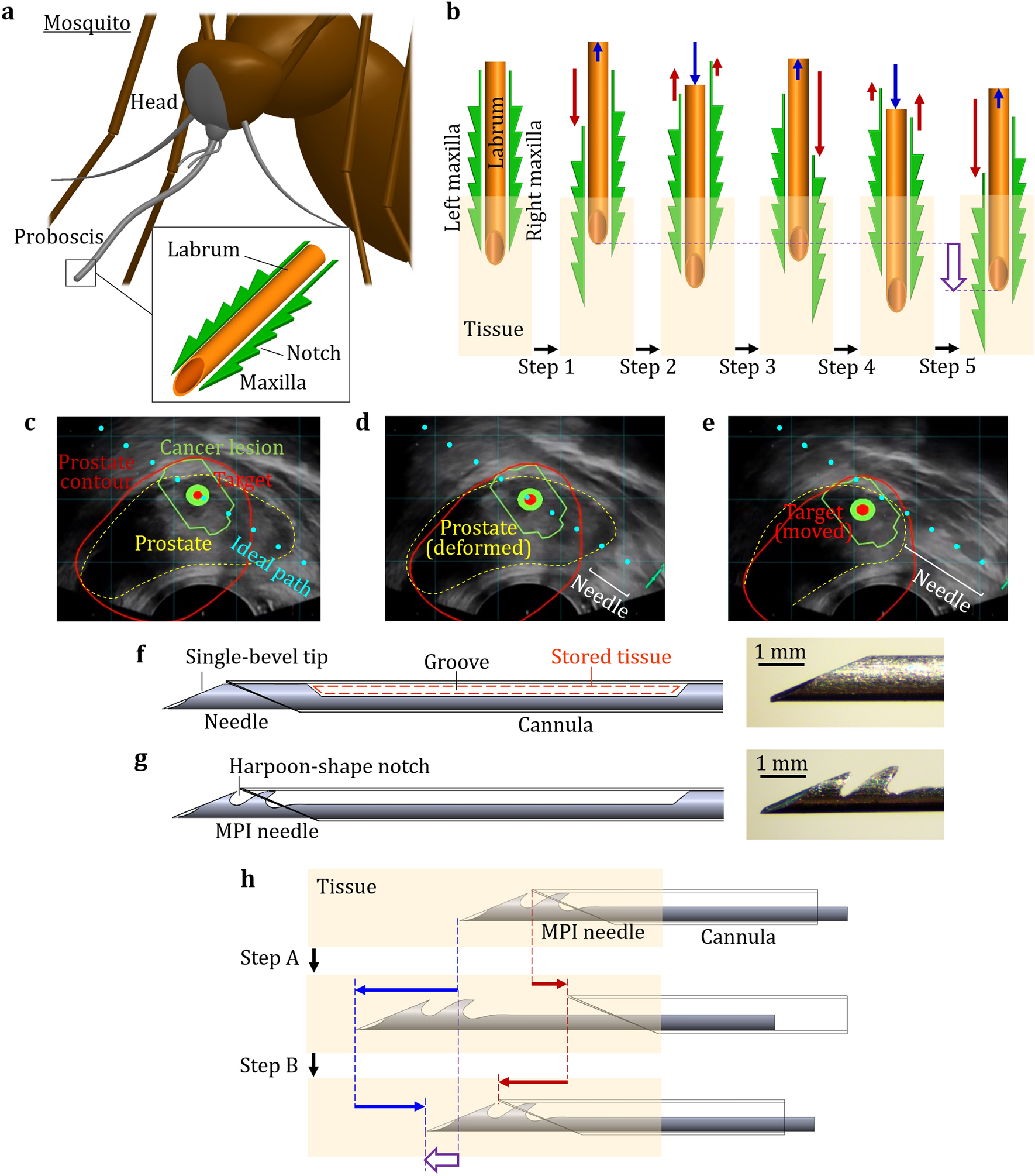 Li and colleagues’ original design figure connecting mosquito mouthparts, alternating movement and the needle-cannula biopsy instrument.
